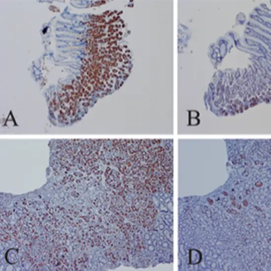 enteroviruses qualitative pcr test